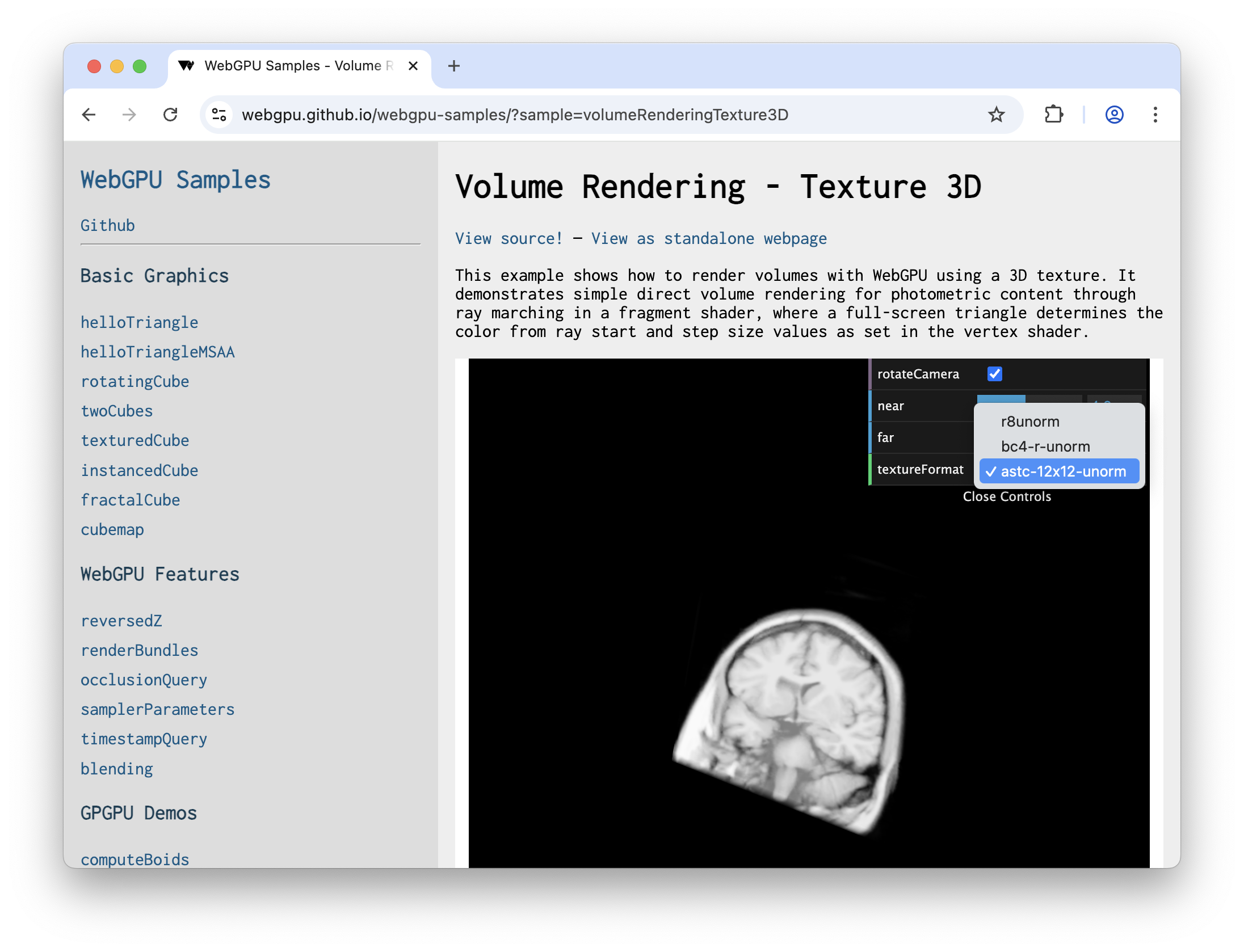 Scansioni cerebrali 3D eseguite utilizzando WebGPU.